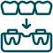 Ikonica zubnog mosta na implantima