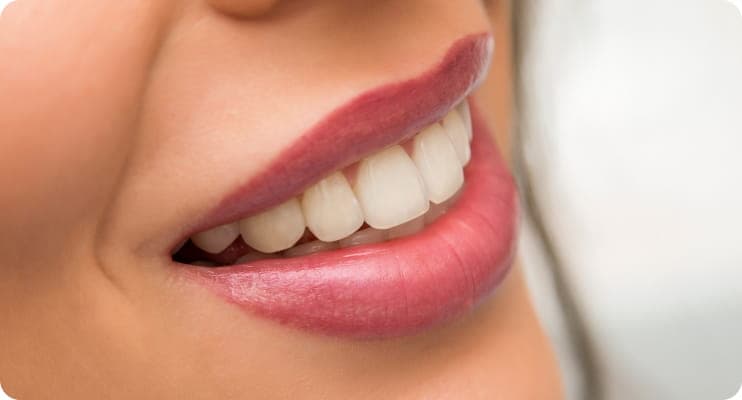 Prirodan osmeh nakon ugradnje zubnog mosta u ordinaciji Dr Popović u Beogradu