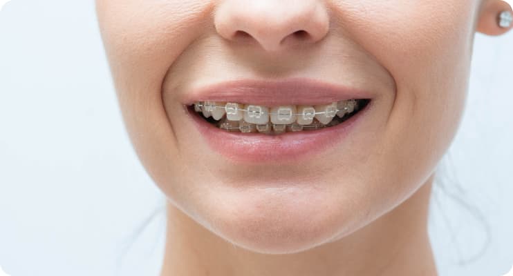 Fiksna proteza na zubima tokom stomatološkog pregleda