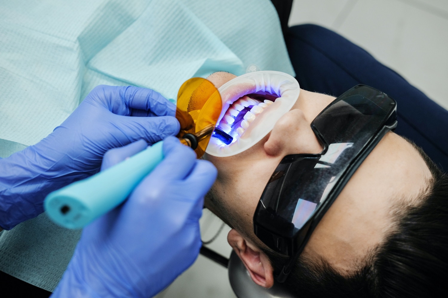 proces ordinacijskog izbeljivanja zuba